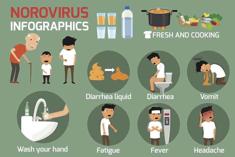 Norovirus outbreak warning issued Bailiwick Express