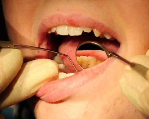 Mouth dentist oral