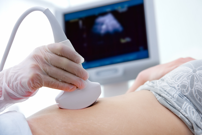 shutterstock scan baby abortion pregnancy pregnant 