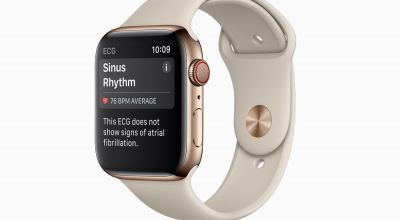 Apple Watch rolls out heart health check features to UK