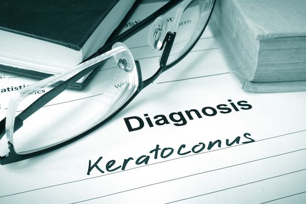 Funding for Keratoconus preventative treatment approved