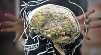 Scientists urge Government to get ahead on brain-computer technology