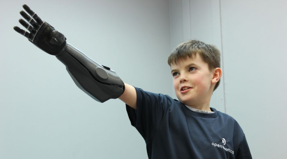 Incredible 3D-printed bionic arms released in world first