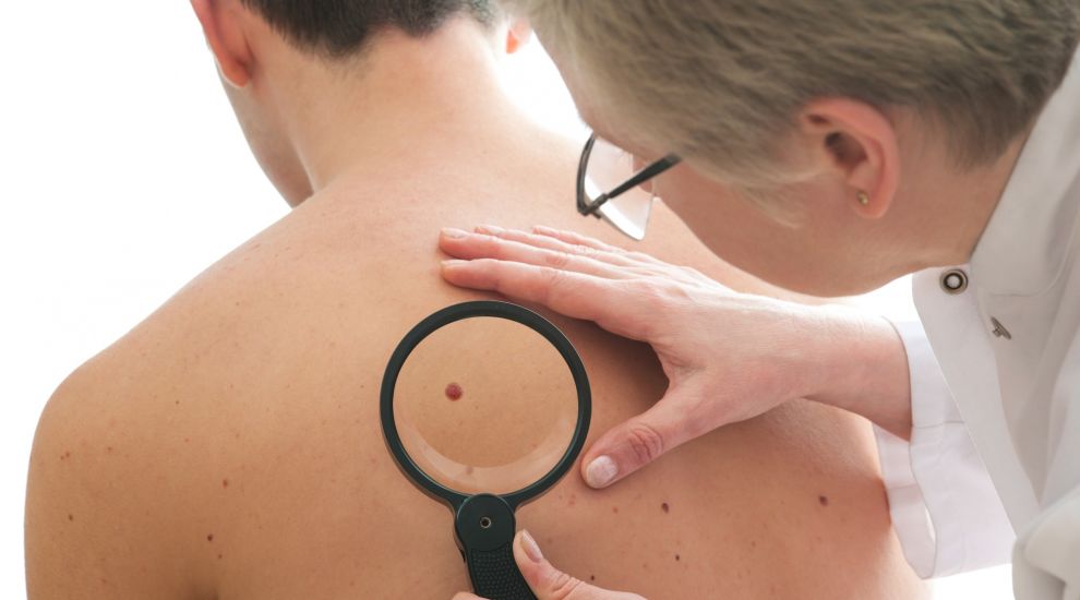 Scientists say AI is now better than humans at spotting skin cancer