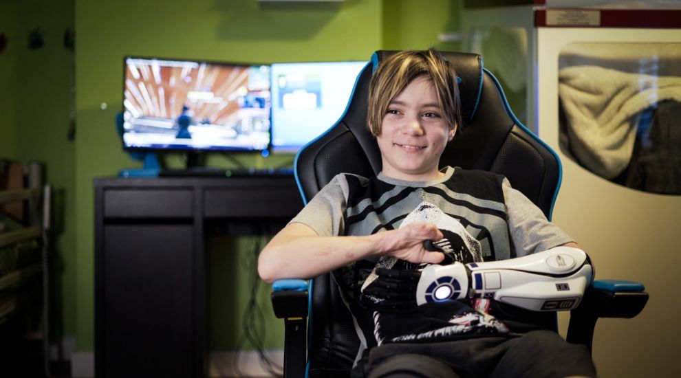 11-year-old quadruple amputee receives Star Wars bionic arm